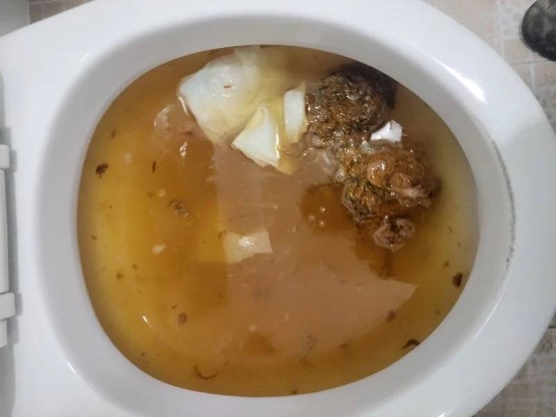 영통 변기막힘 작업사례 5